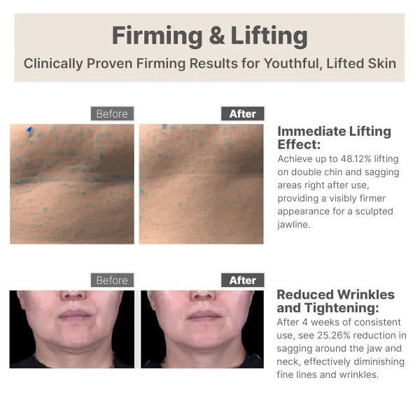 Birch V-Fit Comforting Cream