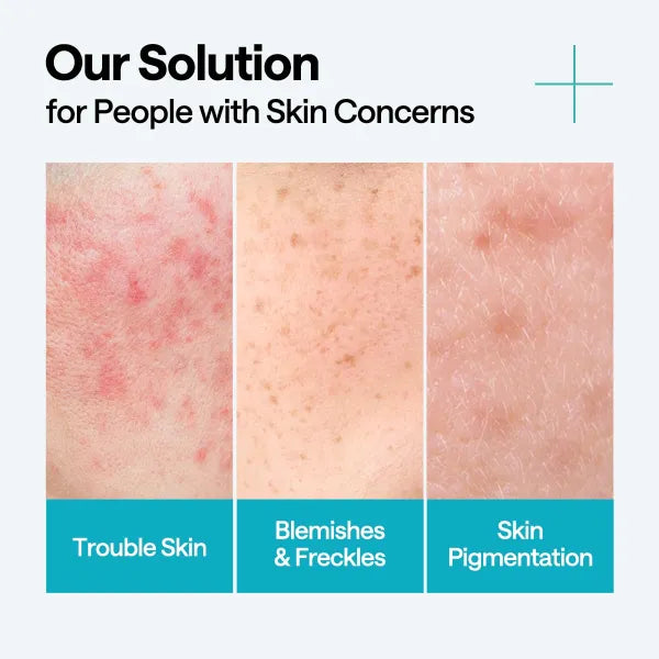 Madecassoside Blemish Repair Serum